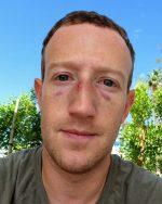 Mark Zuckerberg Injured in Martial Arts Training