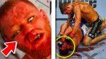 The Most Gruesome Injuries in UFC History